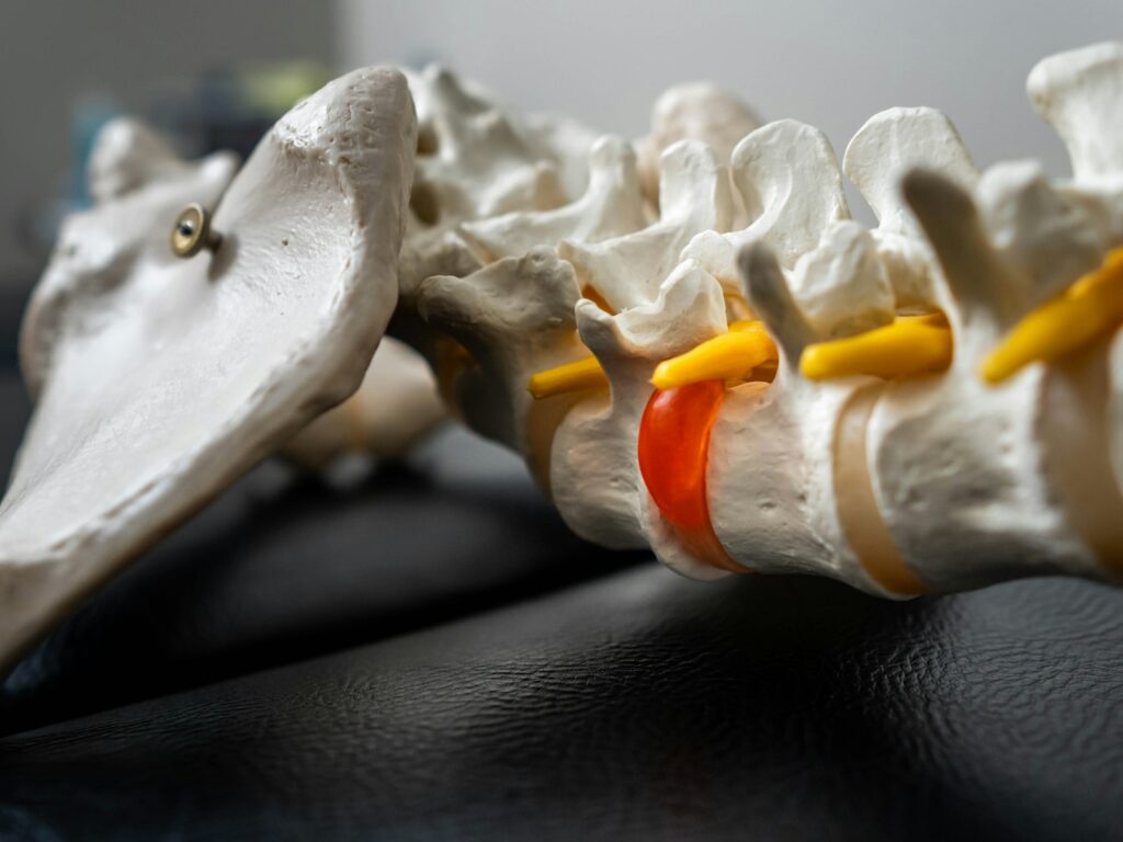Can Physiotherapy Help Sciatica Pain?