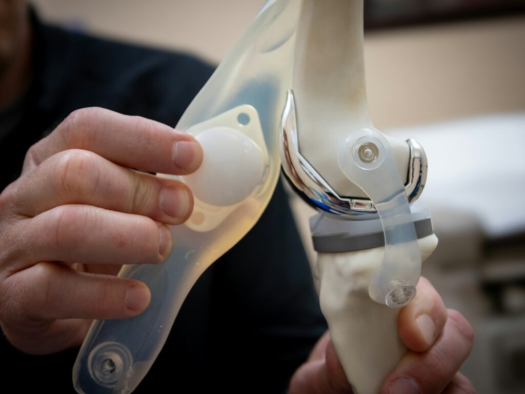 Physiotherapy After Knee Replacement at Home