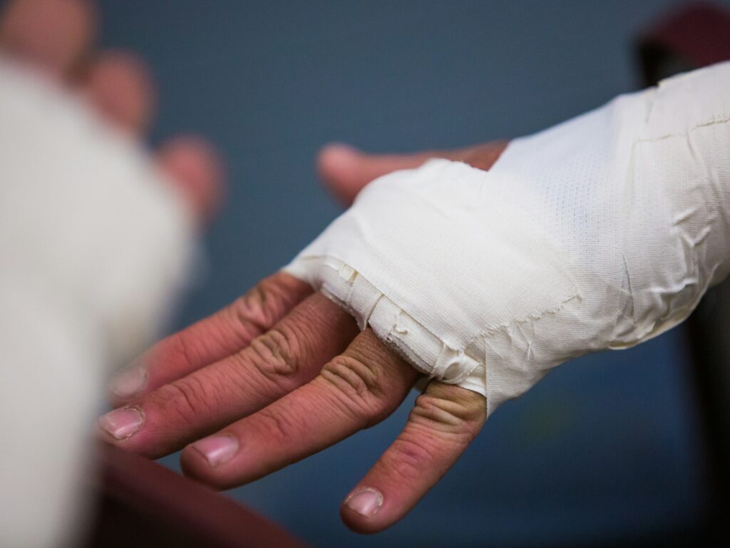 Wrist Fracture Recovery at Home: After the Cast